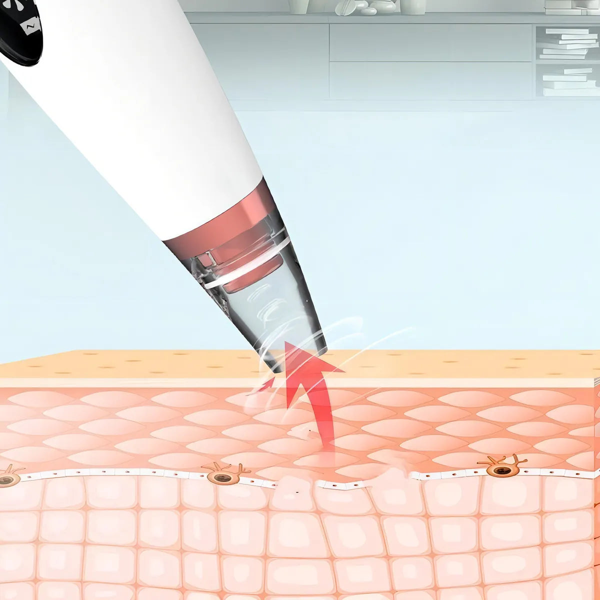 PoreVac Pro Blackhead Remover