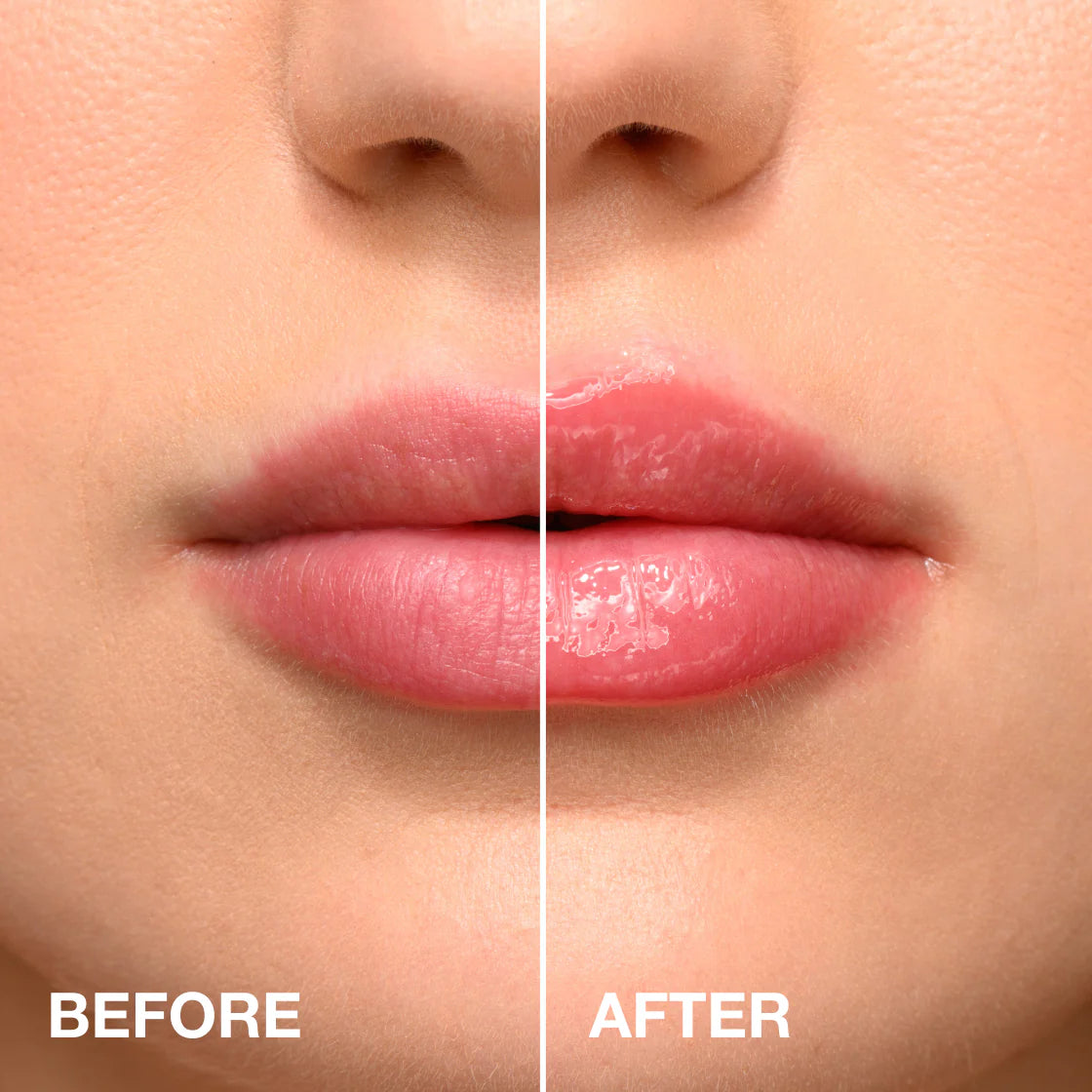 Lip Plumper